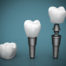 Diş implantlarının uygulanabilmesi için gereken şartlar
