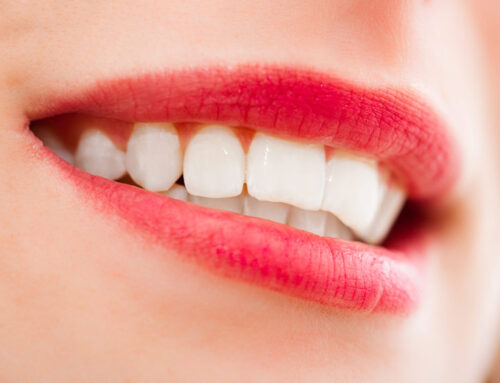 Solutions for White Teeth