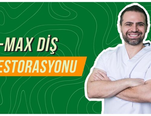 Emax Diş Restorasyonu Nedir? Emax Hangi Dişlere Uygulanır?