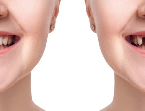 Loss of Front Teeth: Restore Your Smile