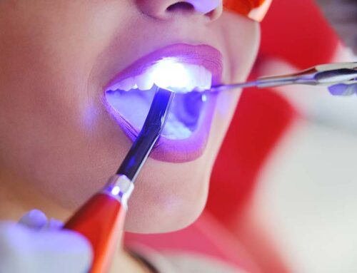 Restorative Dentistry