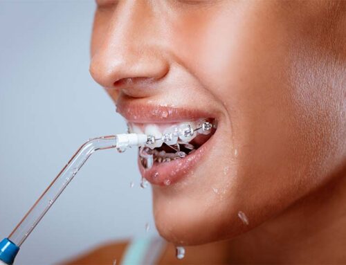 What Is a Water Flosser? How Effective Is It for Oral Hygiene?