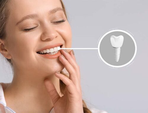 İmplant Tedavisinde Planlama Neden Bu Kadar Önemlidir?